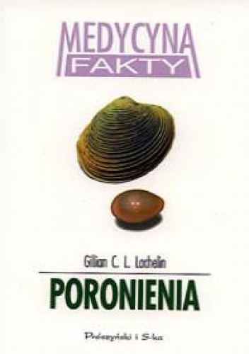 Okładka: Gillian C. L. Lachelin - Poronienia